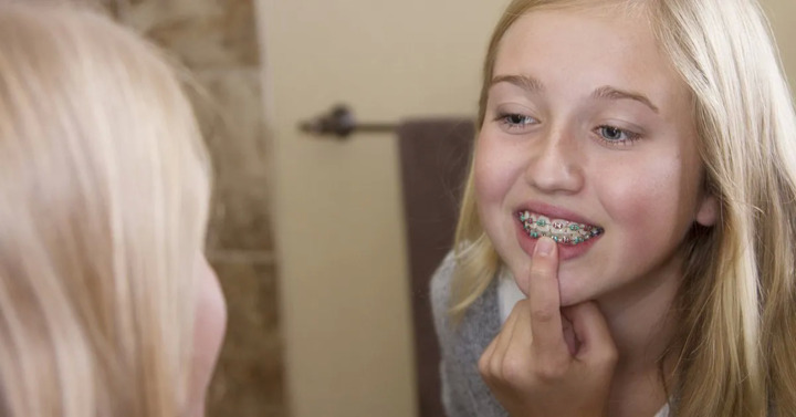 Invisalign or braces: Which should you choose?