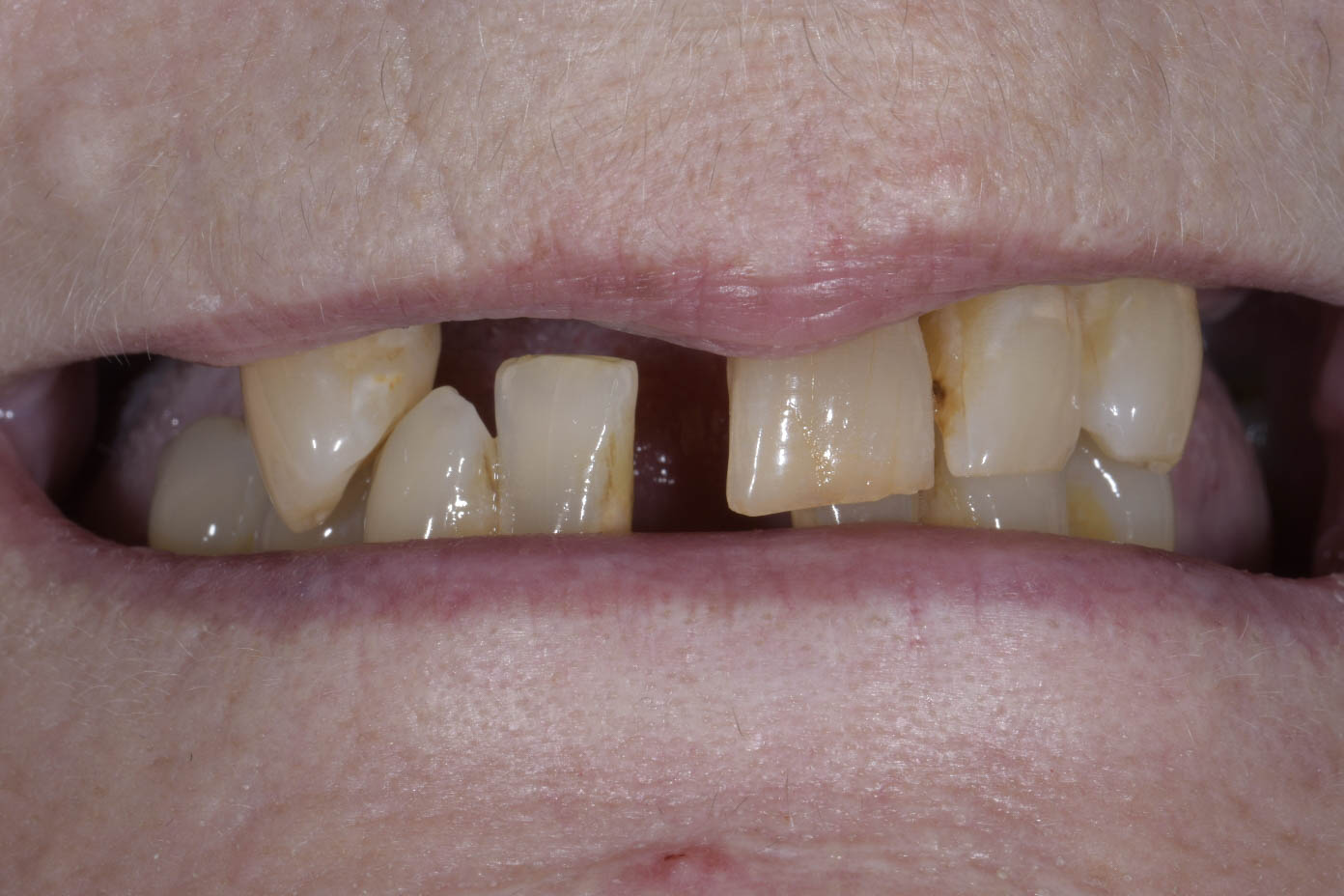 North Shore dentist patient before photo