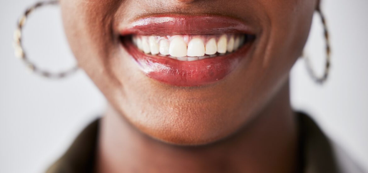 closeup of a professionally whitened smile