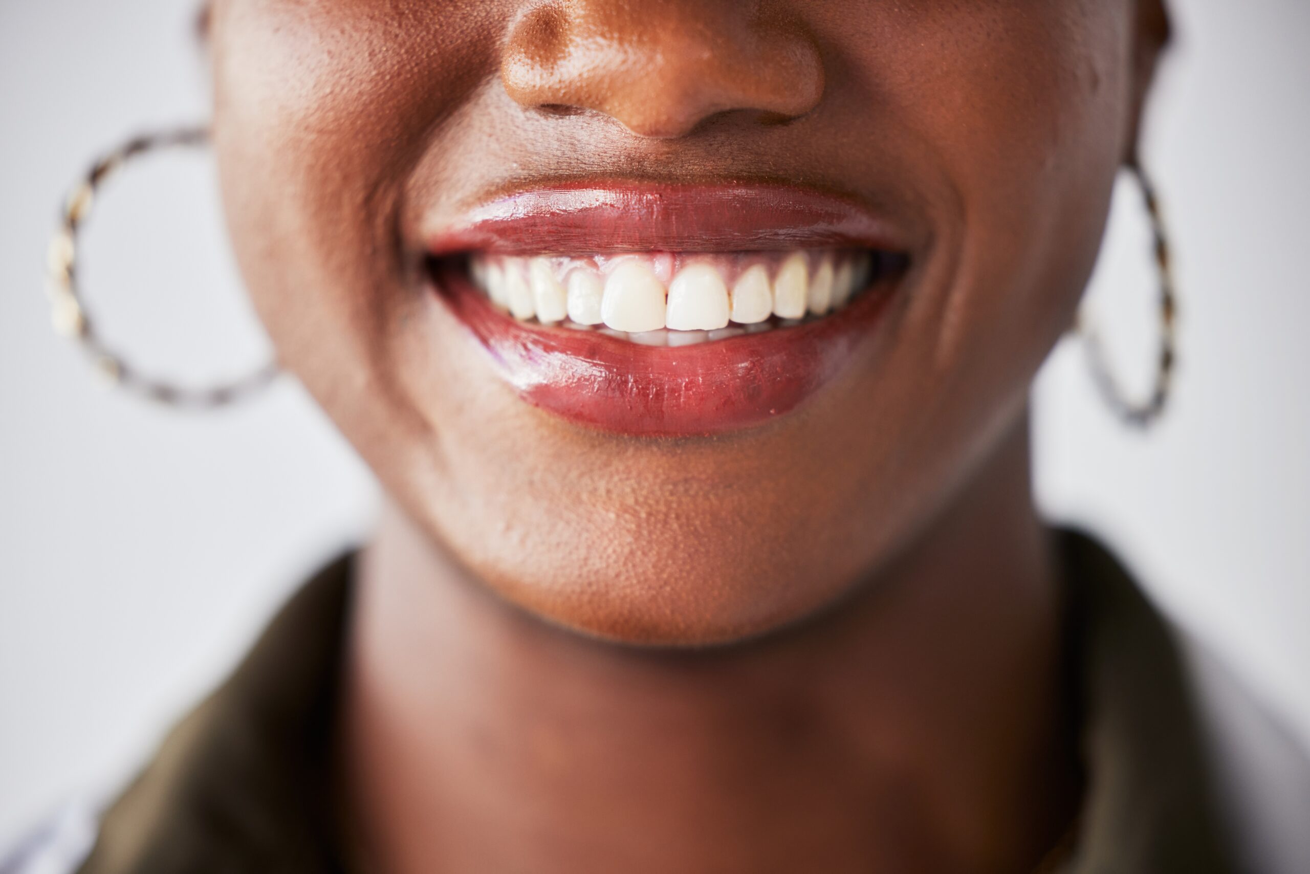 closeup of a professionally whitened smile